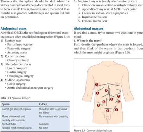 Abdominal Examination Osce Flashcards Quizlet