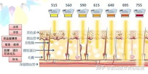 医美不踩坑 嫩肤界实力担当——光子嫩肤 知乎