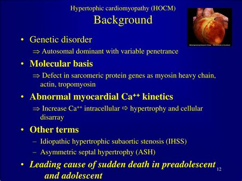 Ppt Hypertrophic Obstructive Cardiomyopathy Case Presentation