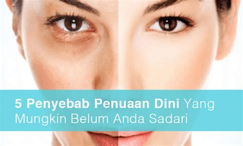 5 Penyebab Penuaan Dini Yang Mungkin Belum Anda Sadari Estetiderma