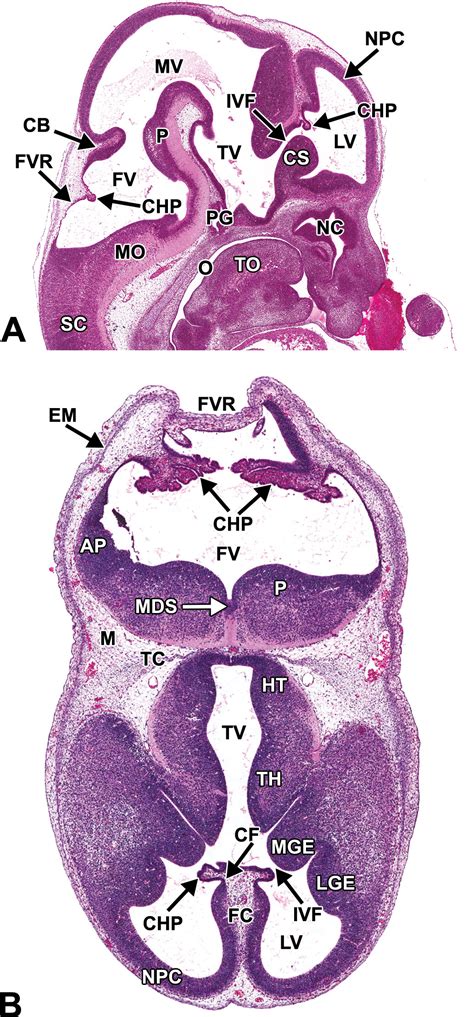 Histology Atlas Of The Developing Prenatal And Postnatal Mouse Central