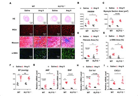 Deficiency Of KLF15 Aggravated Ang II Induced Cardiac Remodeling