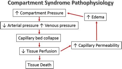 Compartment Syndrome of the Hand | Musculoskeletal Key