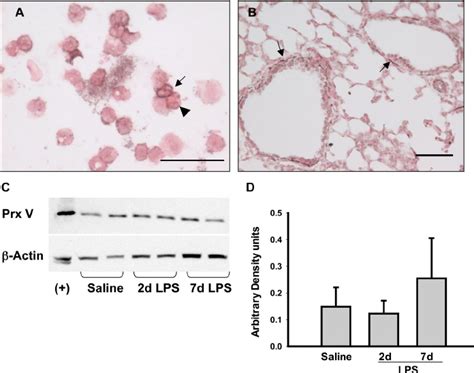 Peroxiredoxin V Prx V Expression After Intra Amniotic Lps A Prx V