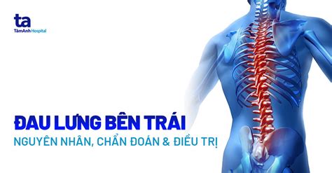 Nguyên nhân gây đau lưng hông bên trái và cách xử lý tại nhà