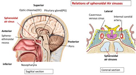 [diagram] Diagram Of Sphenoid Sinuses Mydiagram Online