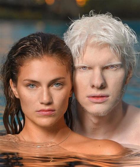 Georgia The Most Handsome Albino Singer Married A Young Model Gave Birth To A Beautiful Son