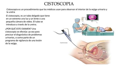 Cistoscopia Escuela Medica Udocz