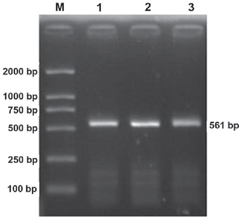 Figure From Activity And Tumor Specificity Of Human Heparanase Gene