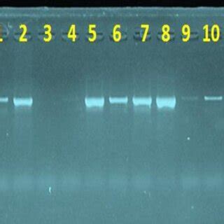 Agarose Gel Electrophoresis Stained With Ethidium Bromide Showing The