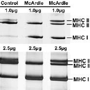 Separation Of The Myosin Heavy Chain MHC Isoforms Into Three Distinct