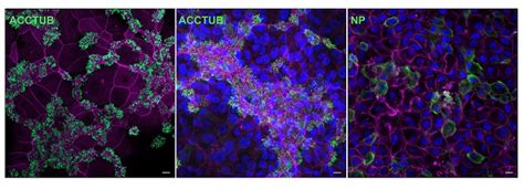 Hku Establishes Mature Airway Organoids For Predicting The Infectivity