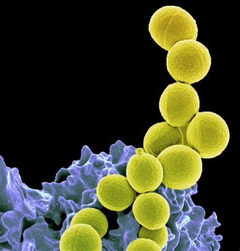 File Methicillin Resistant Staphylococcus Aureus Bacteria