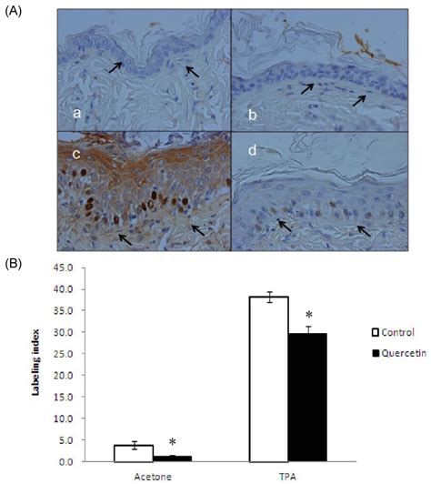 Effect Of Quercetin On Skin Epidermal Hyperplasia And Basal Cell