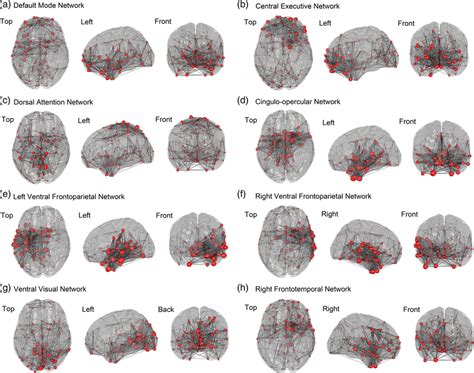 Prototypical Functional Brain Networks Representing Synchrostates