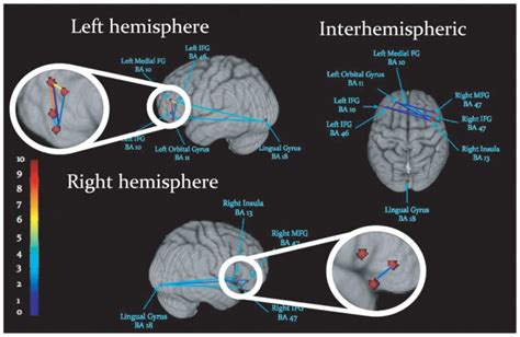 Schematic Display Of Inter Regional Synchronization Where Dots