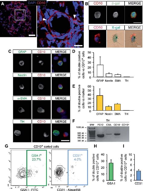 Immunodetection And Characterization Of Cd10 Expression In The Carotid