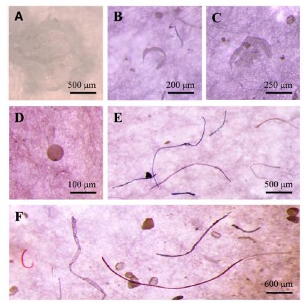 The Occurrence And Consequences Of Microplastics And Nanoplastics In