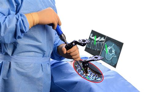 Uc San Diego Health Is Regions First To Use Augmented Reality In Spine Surgery