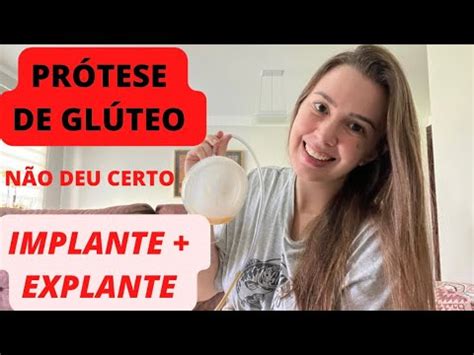 Implante Hormonal Glúteo Antes E Depois - Prótese de glúteo - Implante e Explante - YouTube