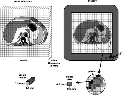 Computed Tomography Radiology Key