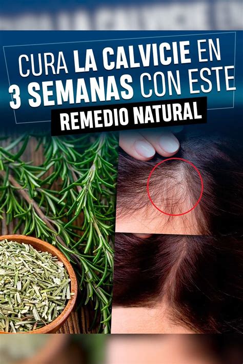 Badabun Cura La Calvicie En 3 Semanas Con Este Remedio Natural