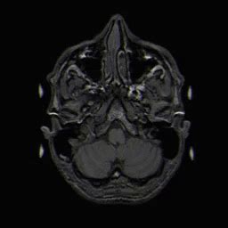 Mri Brain Mri Brain Scan Discover Share GIFs