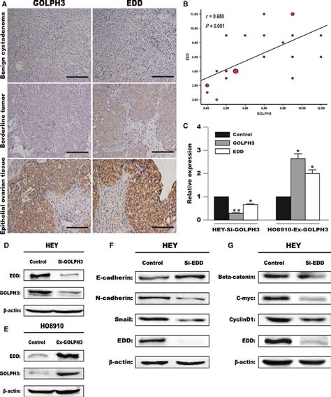 Golph Enhanced Edd Expression During Wnt Signaling Induced Emt In Eoc