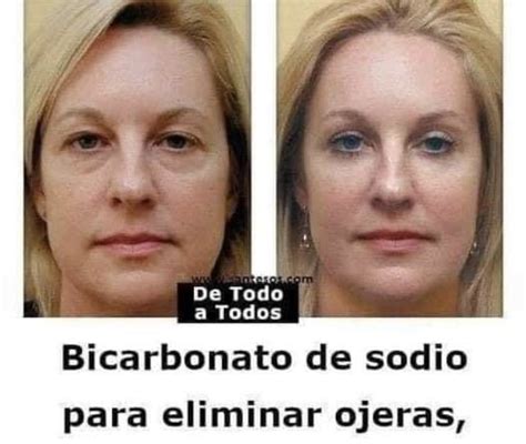 Detiene Las Ojeras Bolsas Y P Rpados Ca Dos Bien De Salud