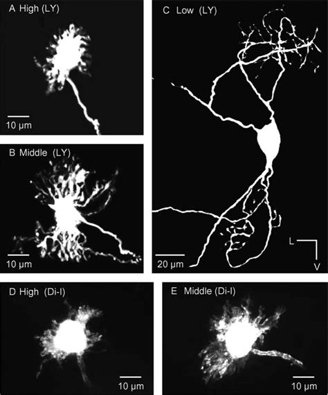 Confocal Images Of NL Neurons A Series Of Pictures Were Taken With A