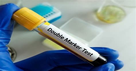 Double Marker Test Procedure Price And Benefits Dr Mona