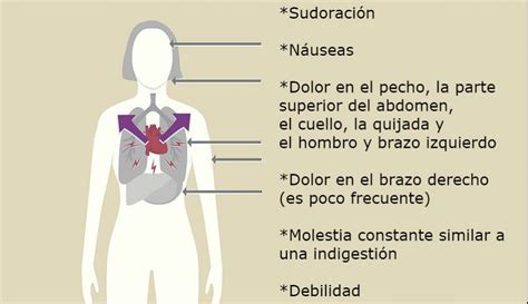 Síntomas de infarto Prevención y Tratamiento 2020