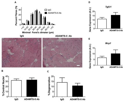 Fast Twitch EDL Muscle Morphology Is Unaffected By ADAMTS 5 Blockade In