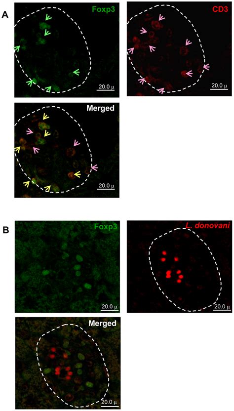 Localization Of Foxp3 Expressing Cells In L Donovani Infected Download Scientific Diagram