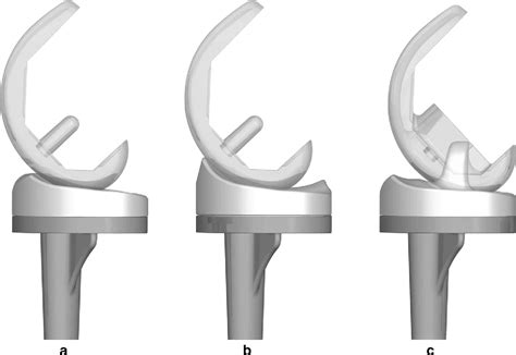 Similar Stability And Range Of Motion Between Cruciate Retaining And