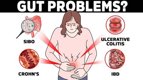 The Quickest Way To Test For Bowel Disease Crohns Ibd Uc Or Sibo Youtube