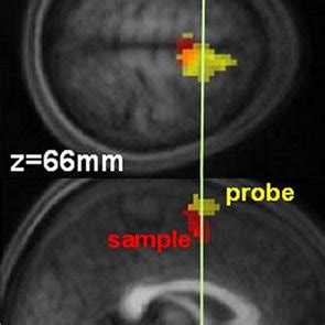 Electrophysiological Activity Over The SMAs In 10 Subjects During A