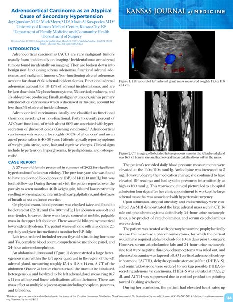 Pdf Adrenocortical Carcinoma As An Atypical Cause Of Secondary