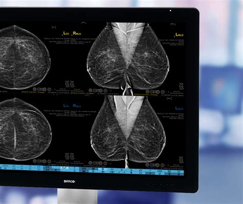 Homepage Hologic 3dimensions Mamography