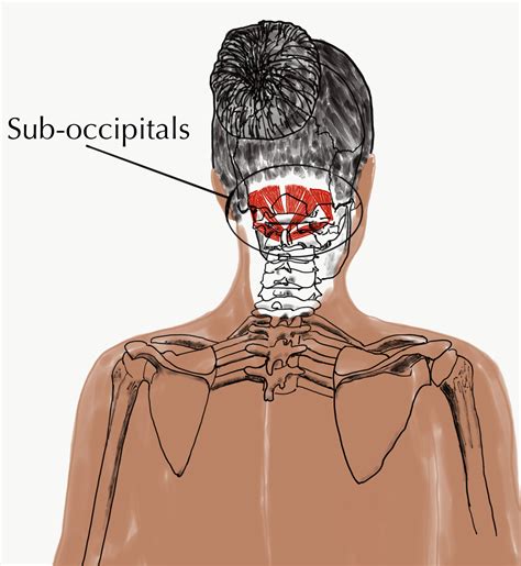 Suboccipital Release Technique