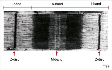 Electron Microscopy Image Of A Striated Muscle Sarcomere Most Of The