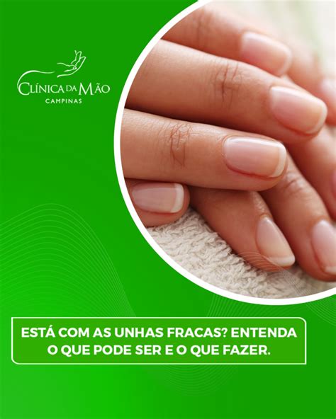 Unha Fraca O Que Pode Ser - Está com as unhas fracas? Entenda o que pode ser e o que fazer ...