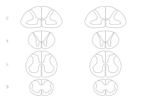 Spinal Cord Blank Diagrams And The Field Museum Patagotitan Sauropod