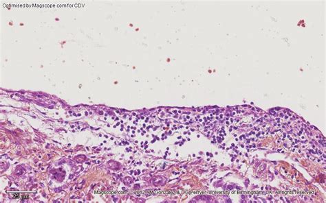 Simple Squamous Histology