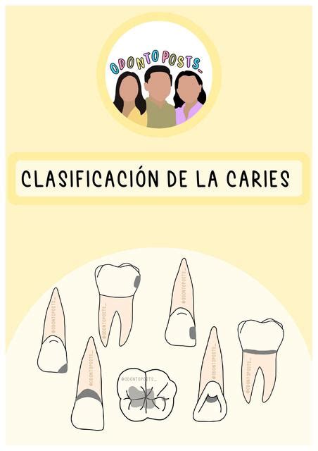 CLASIFICACIÓN DE LA CARIES uDocz