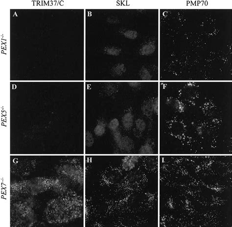 The Trim Gene Encodes A Peroxisomal Ring B Box Coiled Coil Protein