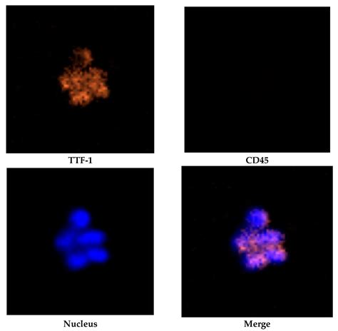 Ijms Free Full Text Isolation Of Ttf 1 Positive Circulating Tumor