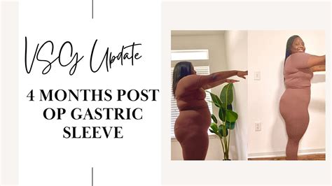 Months Post Op Vsg Update L Vsg Must Haves L Regrets Onederland