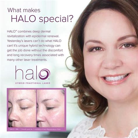 SanctuaryMedicalCenterBoca Posted To Instagram HALO LASER BENEFITS