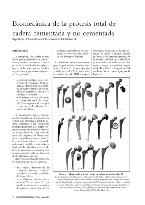 Biomecanica DE LA Protesis DE Cadera Cementada Y NO Cementada 32